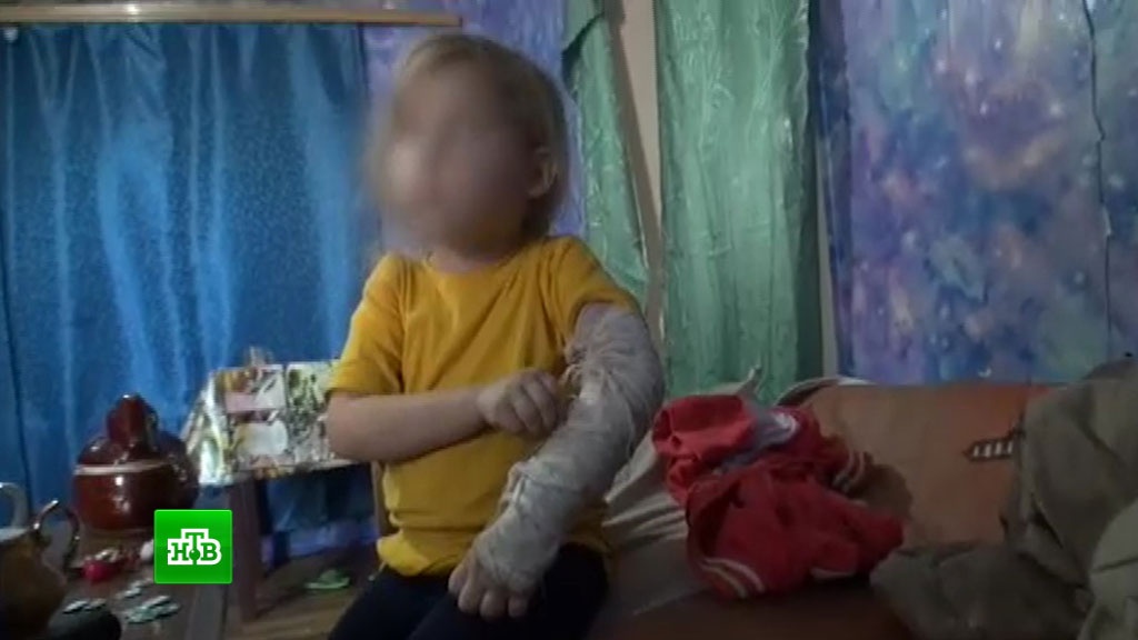 Մայրը փորձել է կտրել 5-ամյա դստեր լեզուն ու դաժան ծեծի է ենթարկել՝ կես տուփ մարգարին ուտելու համար (տեսանյութ)
