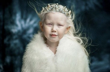 Ութամյա սիբիրցի ալբինոս աղջիկը համացանցի աստղ է դարձել.լուսանկարներ
