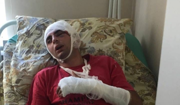 Աբխազիայում հայ պետավտոտեսուչին դաժան ծեծի են ենթարկել և կտրել ականջը
