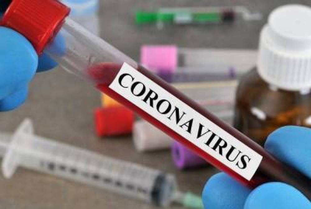 Կորոնավիրուսի վարակման 42 նոր դեպք է գրանցվել. հաստատված դեպքերի թիվը հասավ 1201-ի. ունենք մեկ մահ