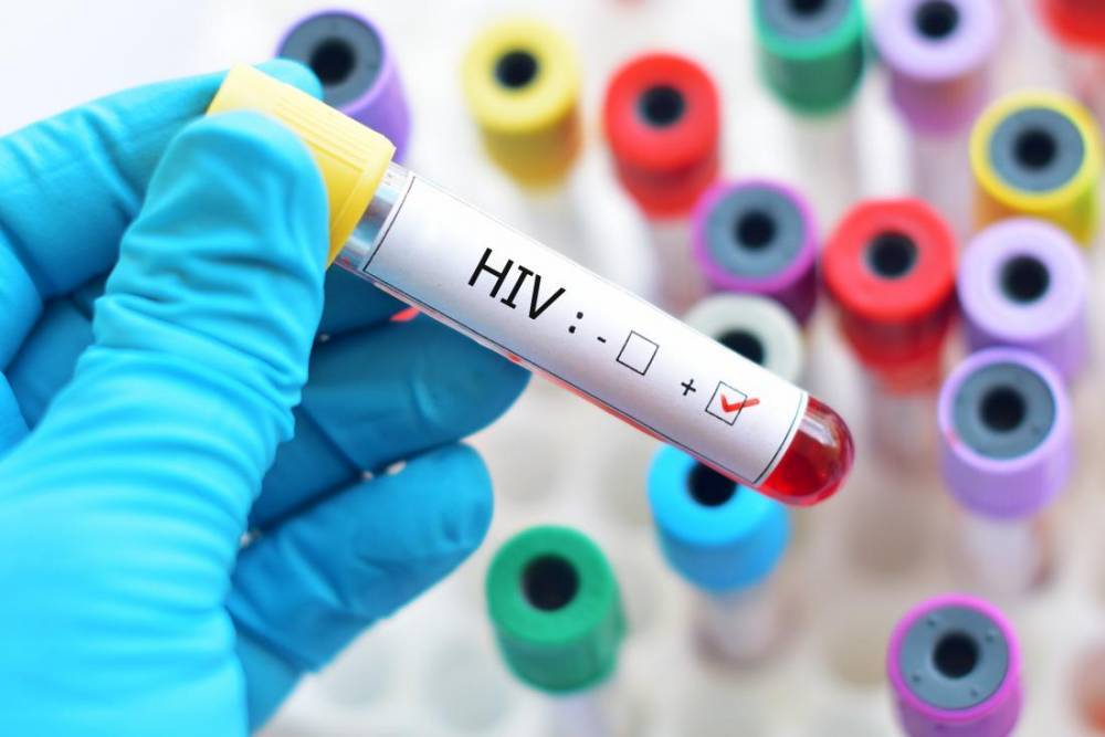 ՄԻԱՎ վարակ ախտորոշումից հետո բոլոր պացիենտներին առաջարկվում է անվճար բուժում. Արսեն Թորոսյան