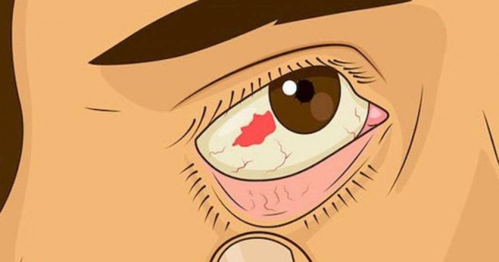 Աչքերի հետ կապված 10 խնդիր, որոնք վկայում են առողջական խնդիրների մասին