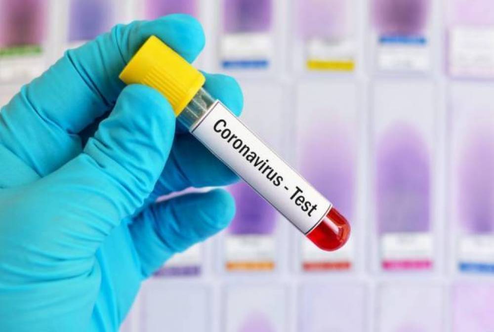 1 օրվա ընթացքում Վրաստանում գրանցվել է կորոնավիրուսով վարակման ընդամենը 11 նոր դեպք
