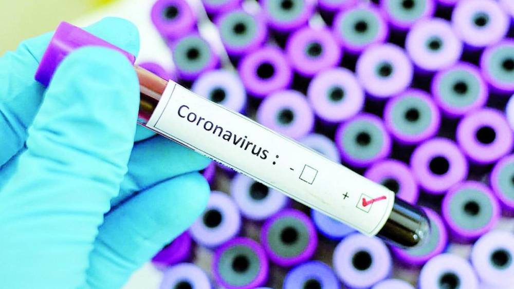 Կորոնավիրուսի վարակման 25 նոր դեպք է գրանցվել. հաստատված դեպքերի թիվը հասավ 290-ի. բուժվածներինը՝ 18-ի