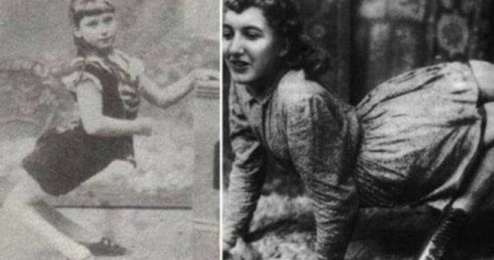 Էլլա Հարփեր՝ աշխարհի միակ աղջիկ-ուղտը, ով բոլորին զարմացրեց իր արտաքինով ու կառուցվածքով