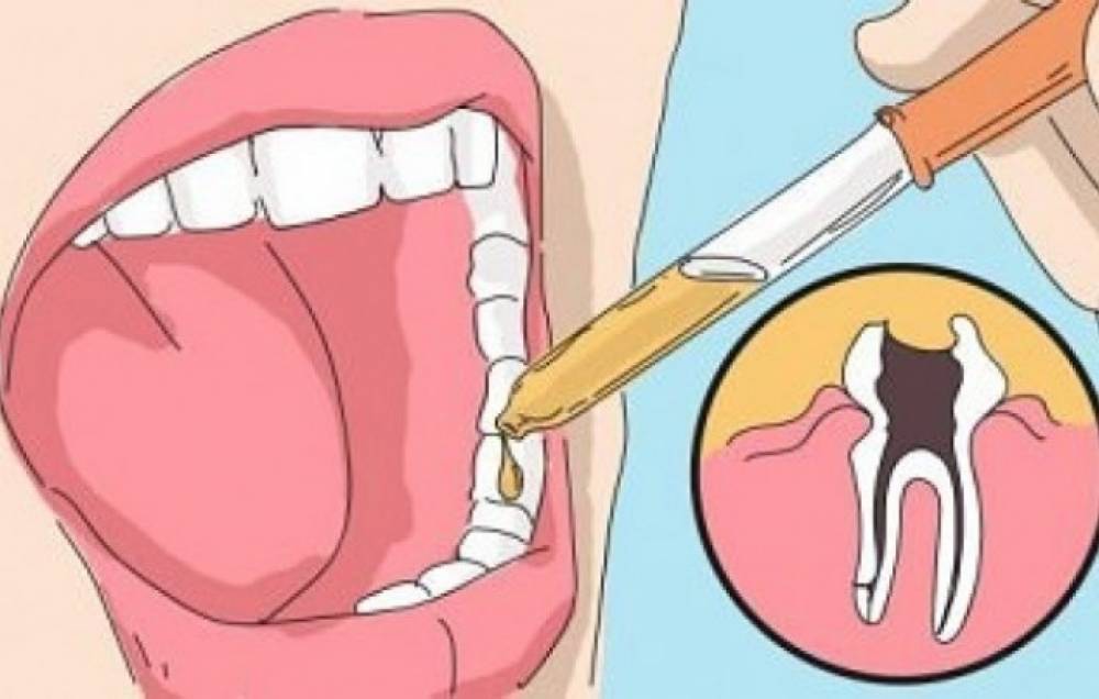Եթե ես շուտ իմանայի ատամի ցավից ազատվելու այս միջոցը, երբեք ատամնաբույժի չէի այցելի