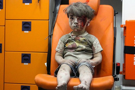 Ինչպես է այժմ Հալեպի տառապանքների խորհրդանիշ դարձած տղան