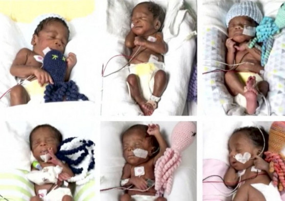 Կինը վեցնյակ է լույս աշխարհ բերել (տեսանյութ)