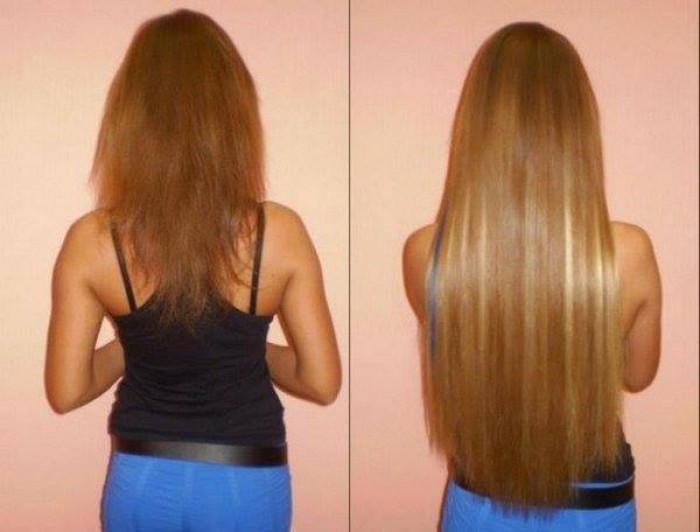 Հիանալի դիմակ` մազերի աճն արագացնելու համար