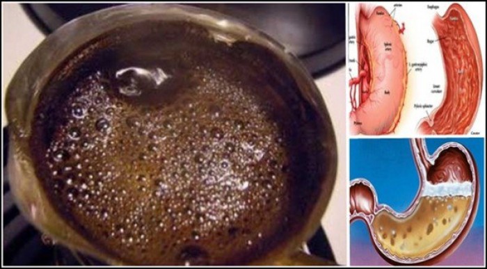 Ահա, թե ինչ է կատարվում ձեր օրգանիզմի հետ, երբ դատարկ ստամոքսին սուրճ եք խմում