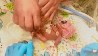 Այս փոքրիկը ծնվել էր ընդամենը 600 գրամ քաշով․ ահա թե ինչպիսին է նա այսօր (տեսանյութ)