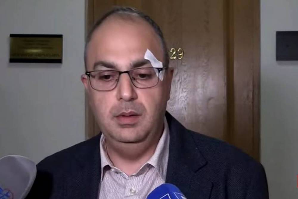 Ինչպես ՔՊ-ականները կորցրին ամոթի զգացումը,և ինչ հակասություններ կան ականատեսների ցուցմունքներում․ «Հրապարակ»