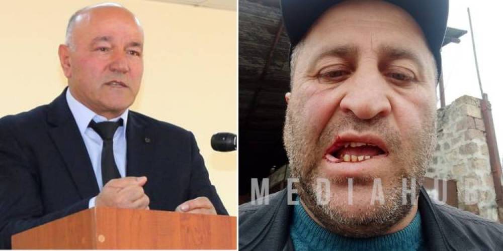 ՊՆ խորհրդական Մելիքսեթ Պողոսյանի «մաֆիան» ինձ ծեծի է ենթարկել․ ծեծկռտուք՝ Տեղ գյուղում