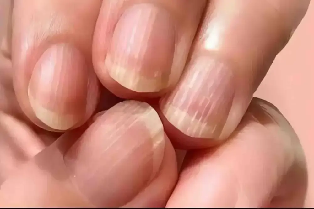 Վիճաբանություն՝ Երևանում․ թիվ 143 հիմնական դպրոցում 43-ամյա կնոջ որդու համադասարանցու հայրը վիճաբանության է բռնվել նրա հետ, որի ժամանակ բռնել է  կնոջ ձեռքը և վնասել ձախ ձեռքի մատնեմատի եղունգ