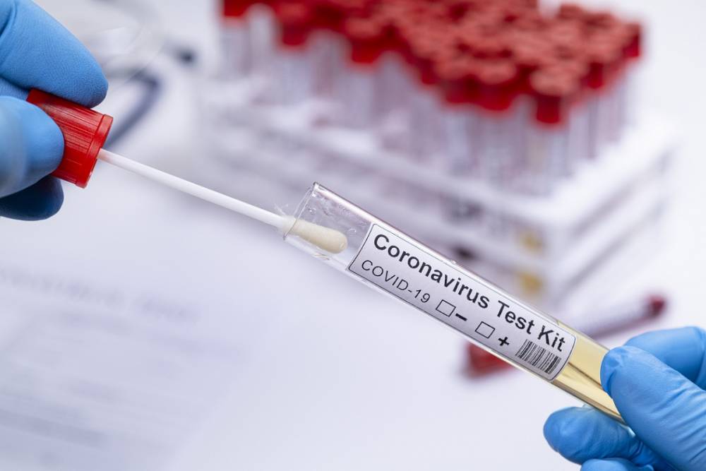 Արցախում կորոնավիրուսի 6 նոր դեպք է գրանցվել