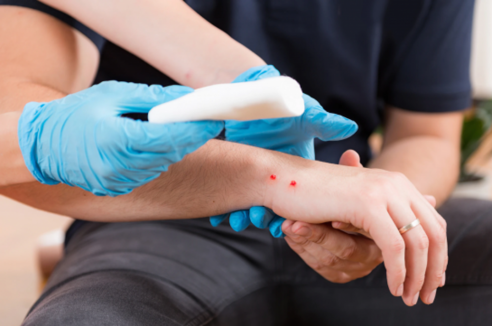 Ամռան ամիսներին հանրապետությունում ավելացել է հատկապես իժի խայթոցի դեպքերը. ի՞նչ անել