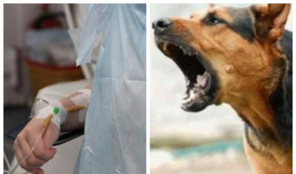 Շան հարձակման հետևանքով հիվանդանոց տեղափոխված կինն այս գիշեր մահացել է. Պատճառը պարզվել է՝ «կատաղություն» հիվանդությունն է