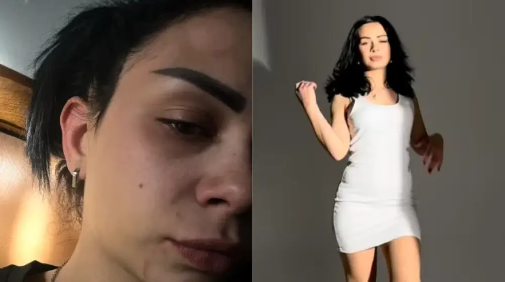 «Բռնությունն ունի այս տեսքը. երբեք մի դատեք այն մարդուն, որի ճանապարհը չգիտեք». Մարի Պետրոսյանի անկեղծ գրառումը