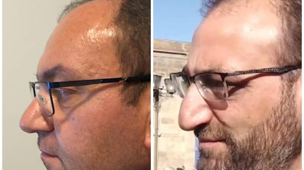 Արսեն Բաբայանն ԱԲ-ի օգնությամբ ծաղրել է ՔԿ փորձաքննությունը