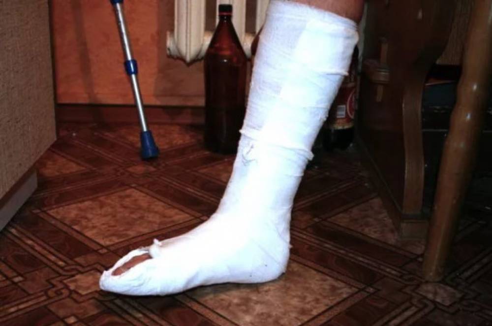 162 դպրոցում կոտրել են աշակերտուհու ոտքը