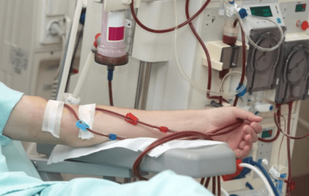 Երևանում հարազատ եղբայրները հարվածներ են հասցրել միմյանց, այդ թվում՝ դանակով