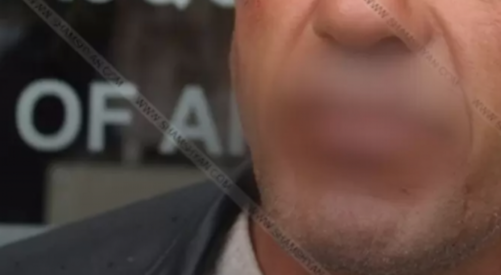 Վանաձորի բանտում դատապարտյալը նախ կարել է շուրթերը, ապա գնդասեղով միացրել իրար