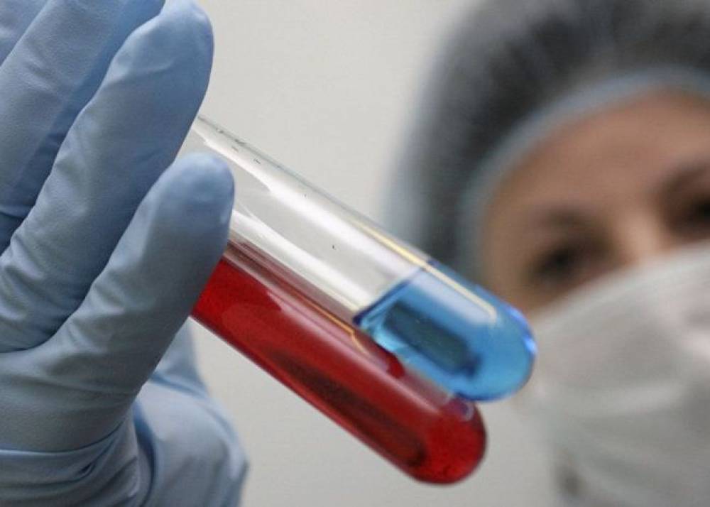 Հայաստանում H1N1 վիրուսով պայմանավորված մահվան երկրորդ դեպքն  է գրանցվել