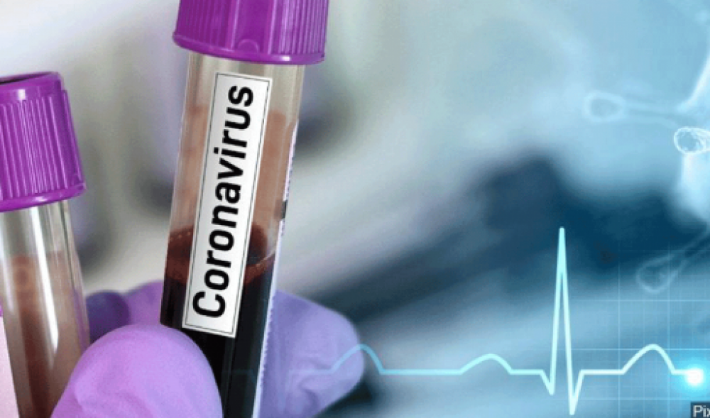 Կորոնավիրուսի դեմ պատվաստանյութը ռուսաստանցիներին հասանելի կլինի օգոստոսի կեսին