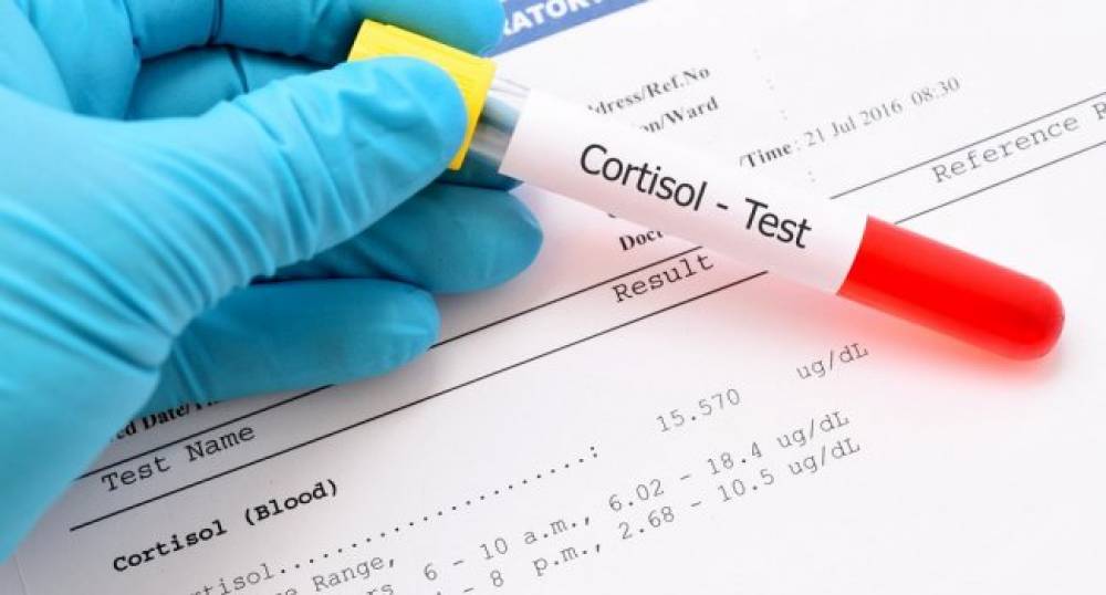 Հայաստանը կրկին 10-րդ տեղում է աշխարհում կորոնավիրուսով վարակման դեպքերի թվով մեկ միլիոն բնակչության հաշվով