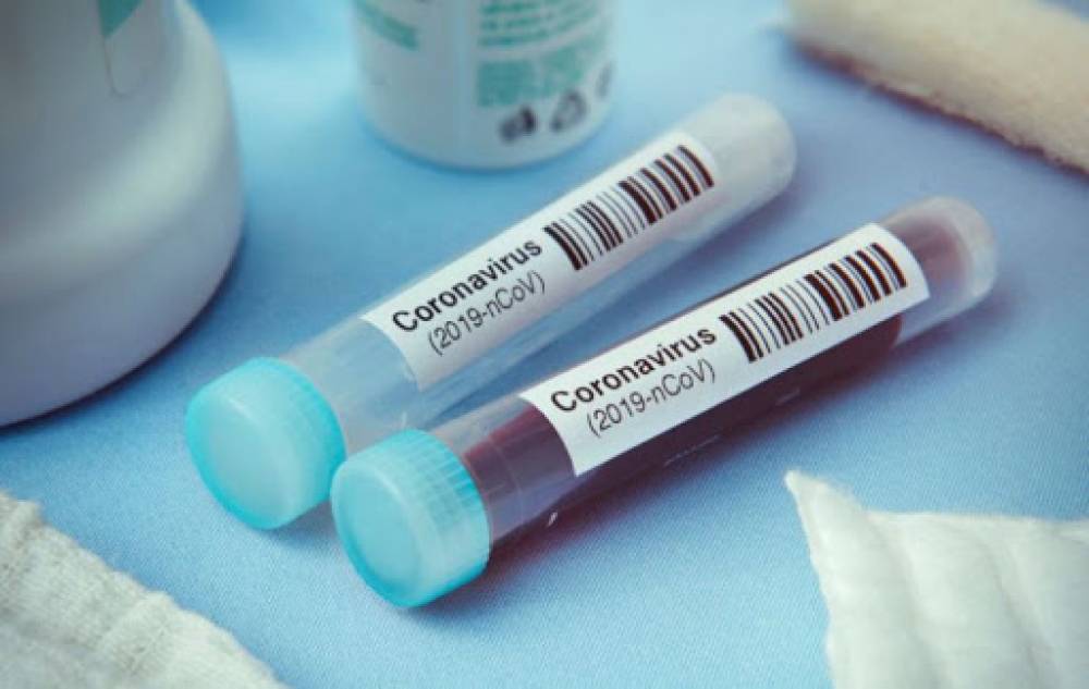 Կորոնավիրուս է հաստատվել Լանջաղբյուրի բուժքրոջ մոտ․ օրեր առաջ նա այցելել է երկու գյուղացու տուն