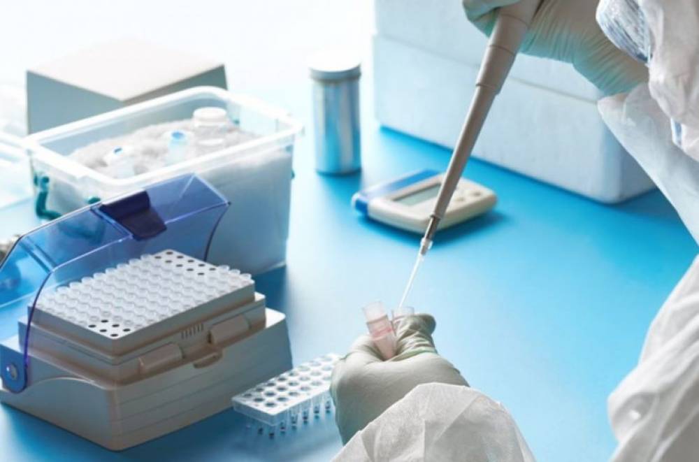 1 մլն շնչի հաշվով վարակման ցուցանիշով Հայաստանը տարածաշրջանում դարձյալ առաջինն է, վիրուսից մահվան ցուցանիշով՝ երկրորդը