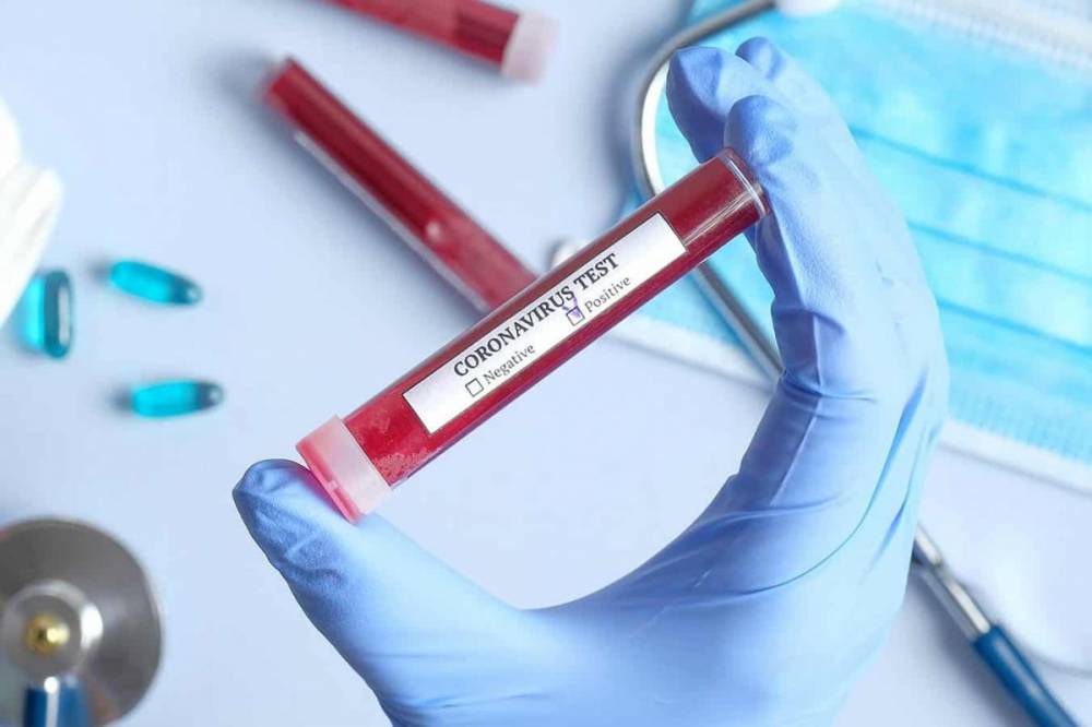 Հայաստանում մեկ օրում հաստատվել է կորոնավիրուսով վարակման 711 նոր դեպք. ունենք 18 մահ, որից 4-ը այլ հիվանդությունից