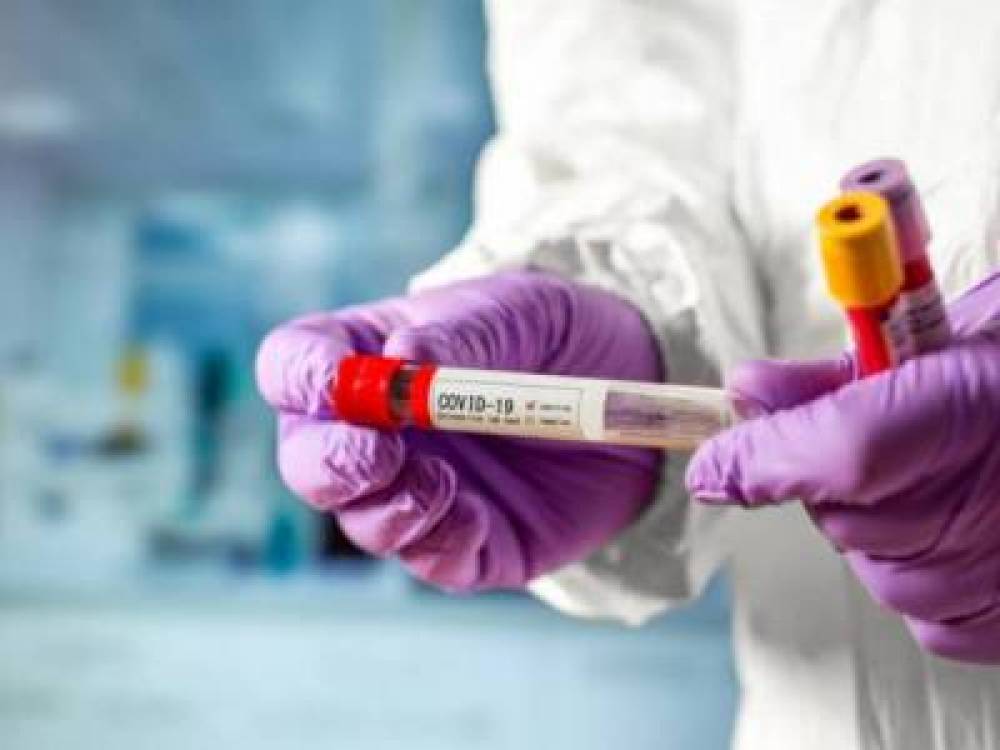 Կորոնավիրուսով վարակման 736 նոր դեպք. կա 6 մահ