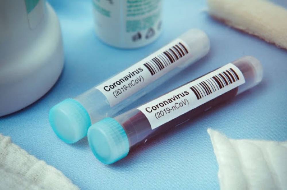 Կորոնավիրուսով վարակման 544 և մահվան 9 նոր դեպք