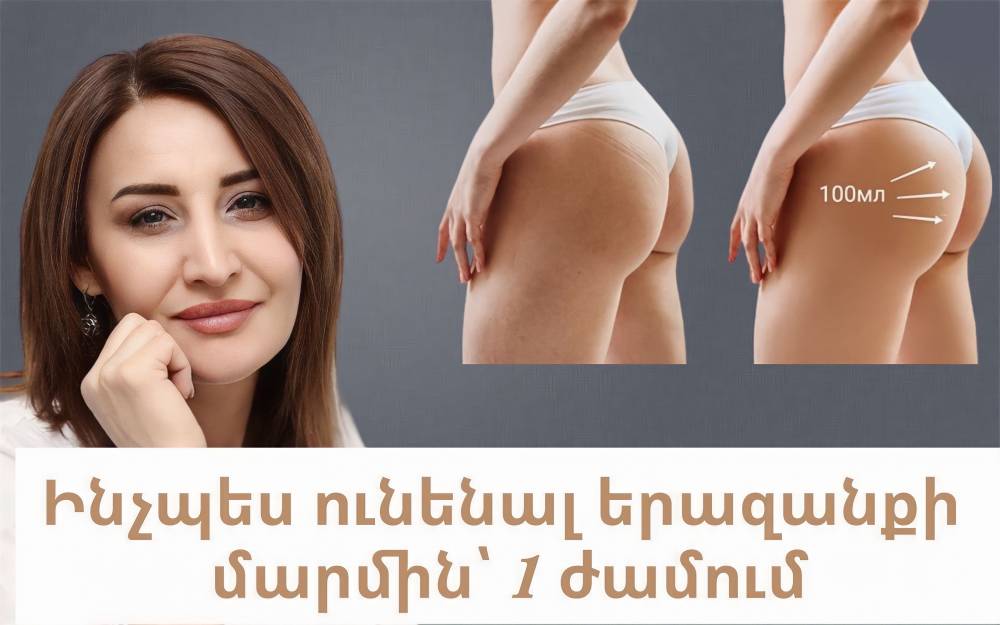 Ինչպես ունենլ երազանքի մարմին՝ մեկ ժամում և մեկ այցելությամբ.Արդյունքը՝ երաշխավորում է բժշկուհի Աննա Հովեյանը