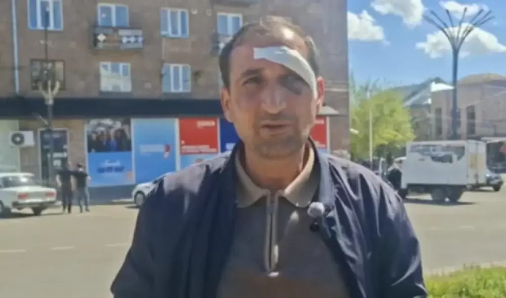 ՔՊ-ականների կողմից Արթիկում ծեծված քաղաքացին բողոքը հետ է վերցրել, պնդում է, որ այլևս բողոք չունի