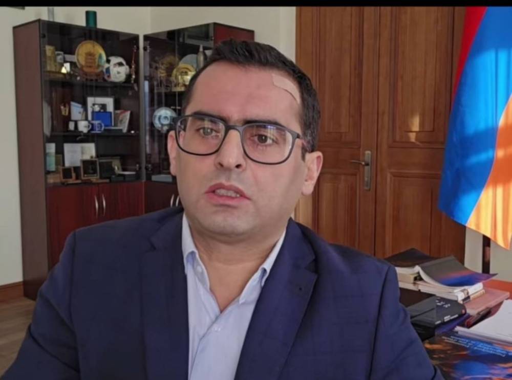 Հակոբ Արշակյանն առաջարկում է ծխախոտի վաճառքի տարիքը 18-ի փոխարեն դարձնել 21 (Տեսանյութ)