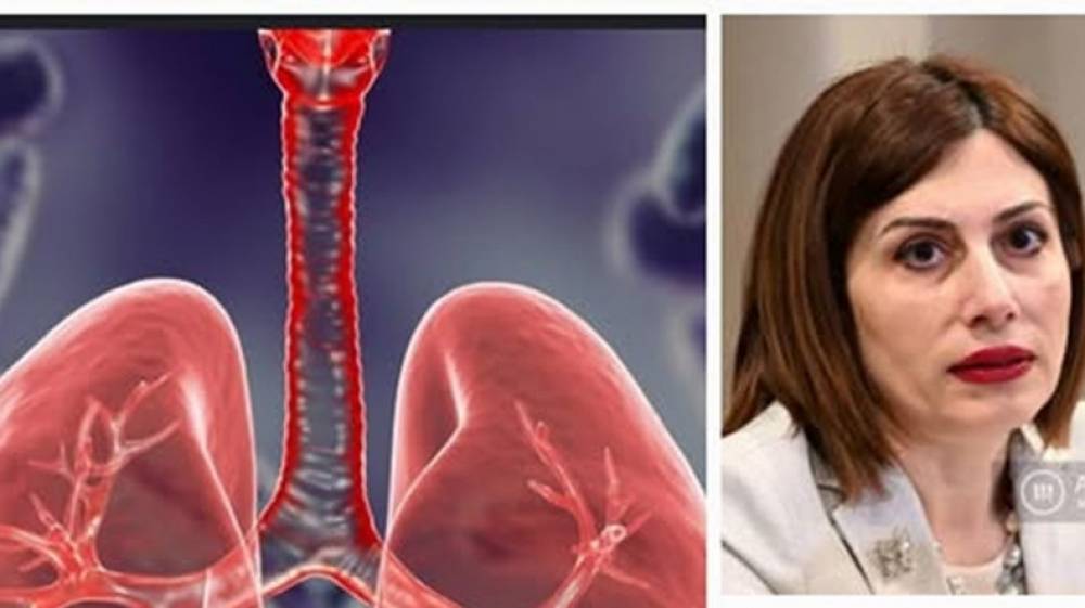 Կանգ առեք. Անուշ Պողոսյանը՝ ԱՆ պաշտոնյաներին