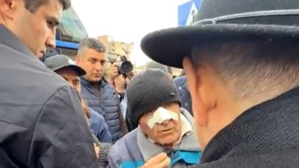 Ինձ ինվալիդ սարքեցիր, էլ բուժում չկա. Քաղցկեղով հիվանդ տղամարդը՝ Փաշինյանին