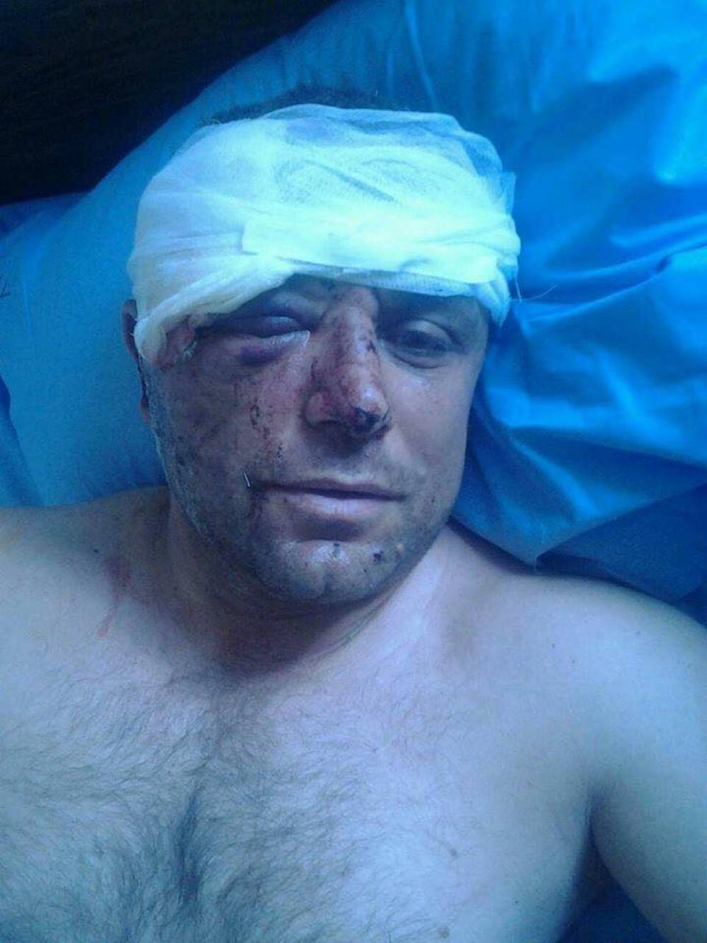 Տուժած քաղաքացին դիմում է Վալերի Օսիպյանին (տեսանյութ, լուսանկար)