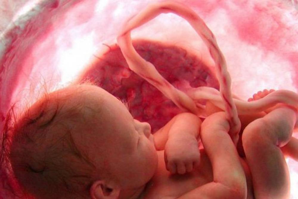 Կարո՞ղ է արդյոք պտուղը վարակվել կորոնավիրուսով հղիության ընթացքում