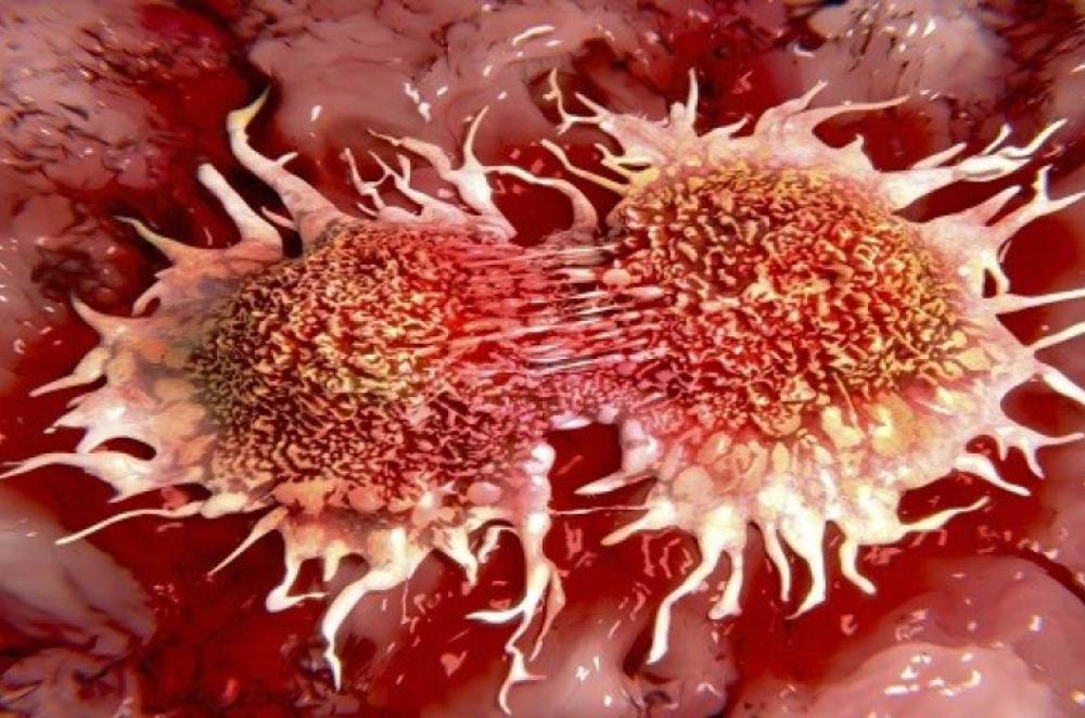 Քաղցկեղի առաջացման 10 հիմնական պատճառ, որոնց մարդիկ առնչվում են ամեն օր