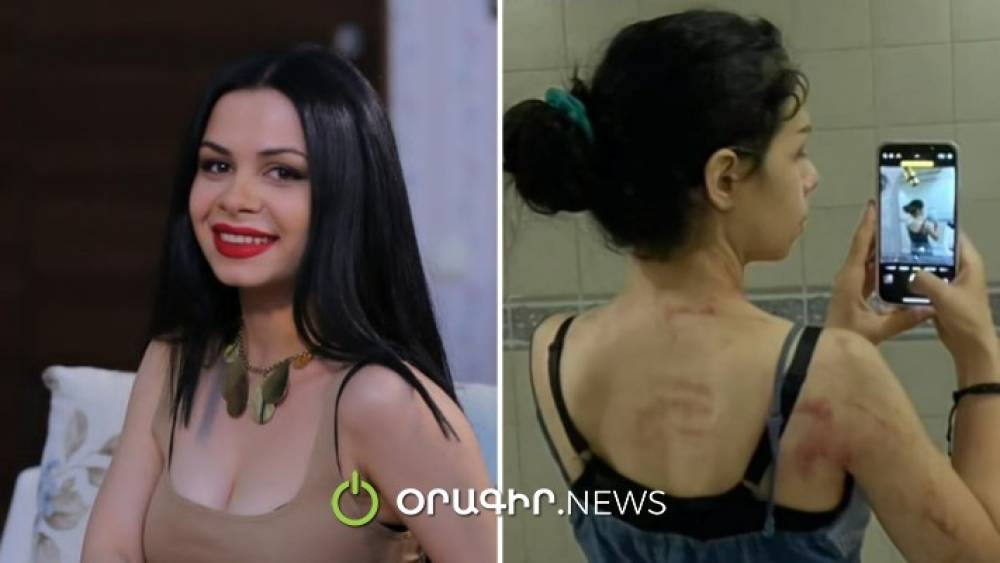 «Ազիզյաններ»-ի Մարին բռնությшն է ենթարկվել ամուսնու կողմից