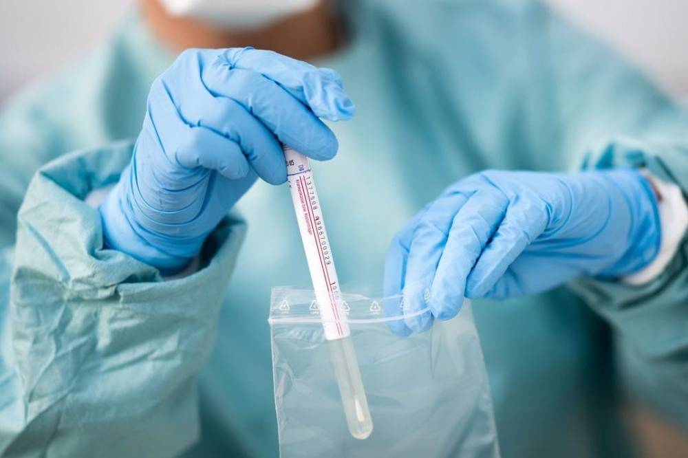 Կորոնավիրուսից մահացած 7 անձանցից ամենաերիտասարդը 47-ամյա տղամարդն է. նա ուղեկցող հիվանդություն չի ունեցել