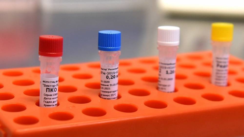 Կորոնավիրուսով վարակման 458 նոր դեպք մեկ օրում. մահացել է 2 մարդ